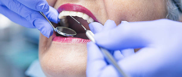 Best Urgent Tooth Repair  in Kingsley, MI